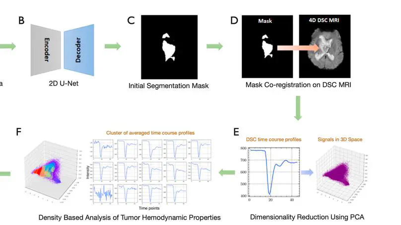 Hemodynamic property incorporated brain tumor segmentation by deep learning and density-based analysis of dynamic susceptibility contrast-enhanced magnetic resonance imaging (MRI)