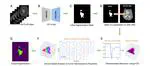 Hemodynamic property incorporated brain tumor segmentation by deep learning and density-based analysis of dynamic susceptibility contrast-enhanced magnetic resonance imaging (MRI)